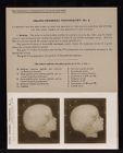 Cranio-Cerebral Topography - no. 4